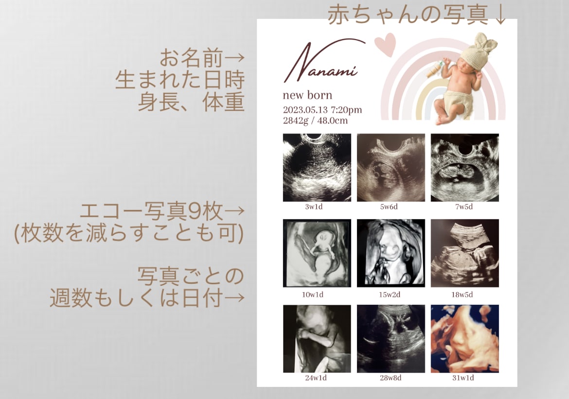 赤ちゃんの写真入りエコー写真ポスター作ります 大切な赤ちゃんの思い出をおしゃれに残しませんか？ イメージ9