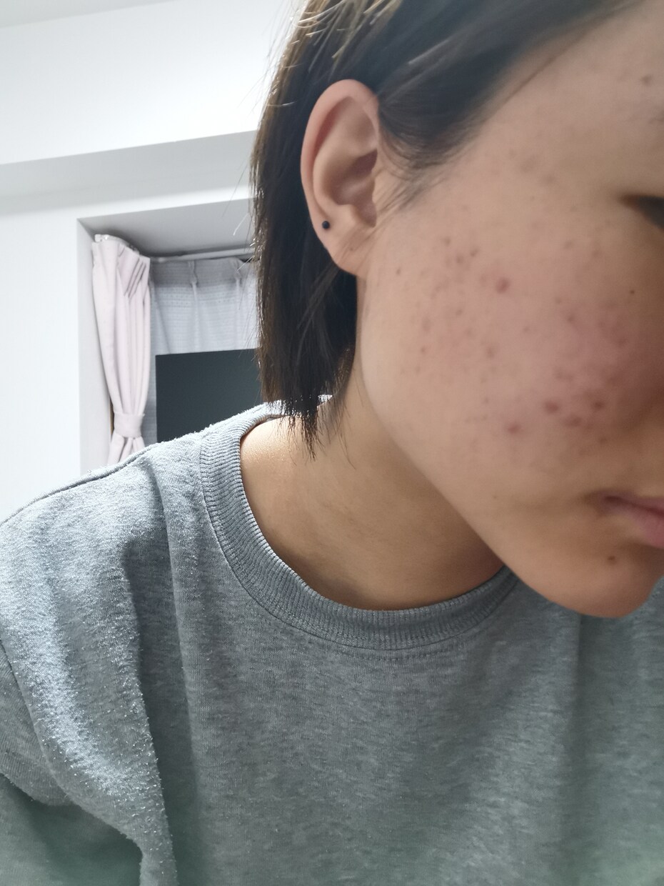 お肌悩みがある方、根本のお肌の構造からお教えします 年代問いません！気になるお肌悩み改善させます！ イメージ2