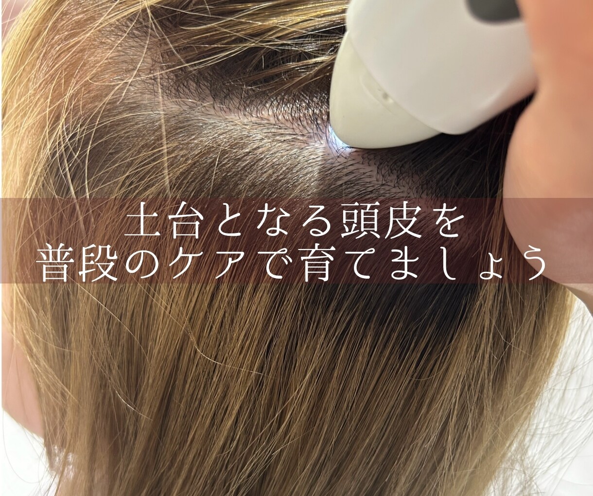髪と頭皮にお悩みの方へ専門家が答えます 美容師免許保有・現役ヘッドスパニストの美容お悩み相談室 イメージ4