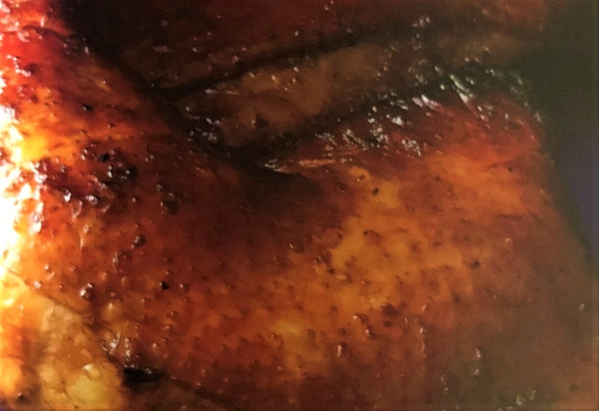 簡単な　⭐漬けるだけのレシピ5品⭐　教えます 日々のお料理をもっと簡単に栄養豊富な食生活をしませんか？⭐ イメージ3