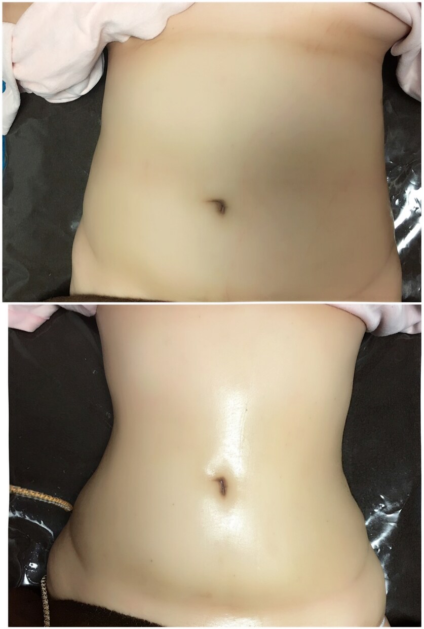 痩せたい人必見！！痩せさせます 痩せる痩せる痩せる！！やせまくり！！ イメージ3