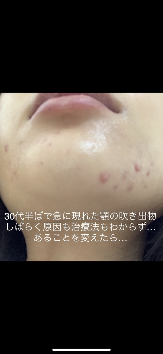 すっぴん美肌になろう！あなたの美肌コンサルします 美肌見直し本舗★今の美容法、ゼロから見直してみませんか？ イメージ7