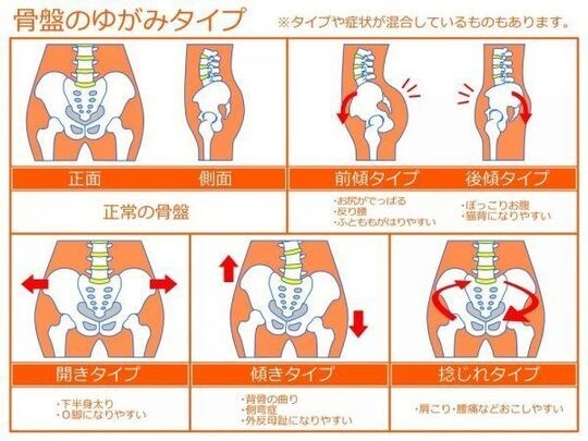 腰痛、肩こりなど症状改善の自己調整法を教えます 米国カイロ大学留学の知識と経験を元にアドバイス イメージ5