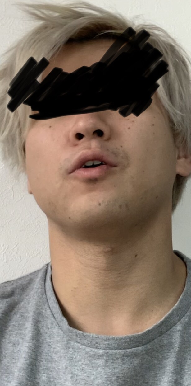 本当にいい永久脱毛の仕方を教えます 脱毛業界は誇大広告ばかり脱毛店長に聞いた選ぶべきポイントとは イメージ2