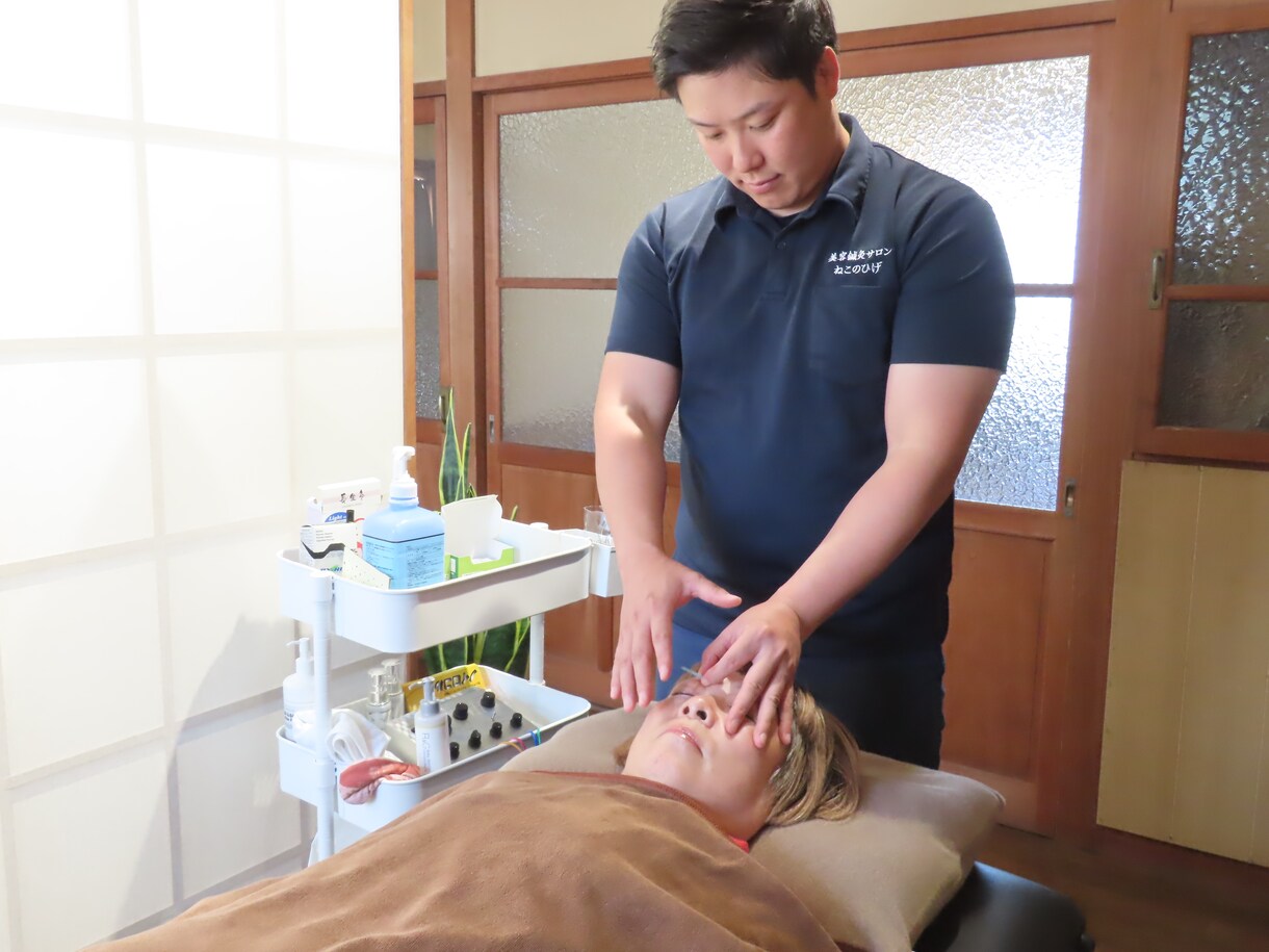 顔に鍼を打ってるだけ”から卒業できます お客様に変化を実感させる美容鍼の基礎からの打ち方 イメージ7