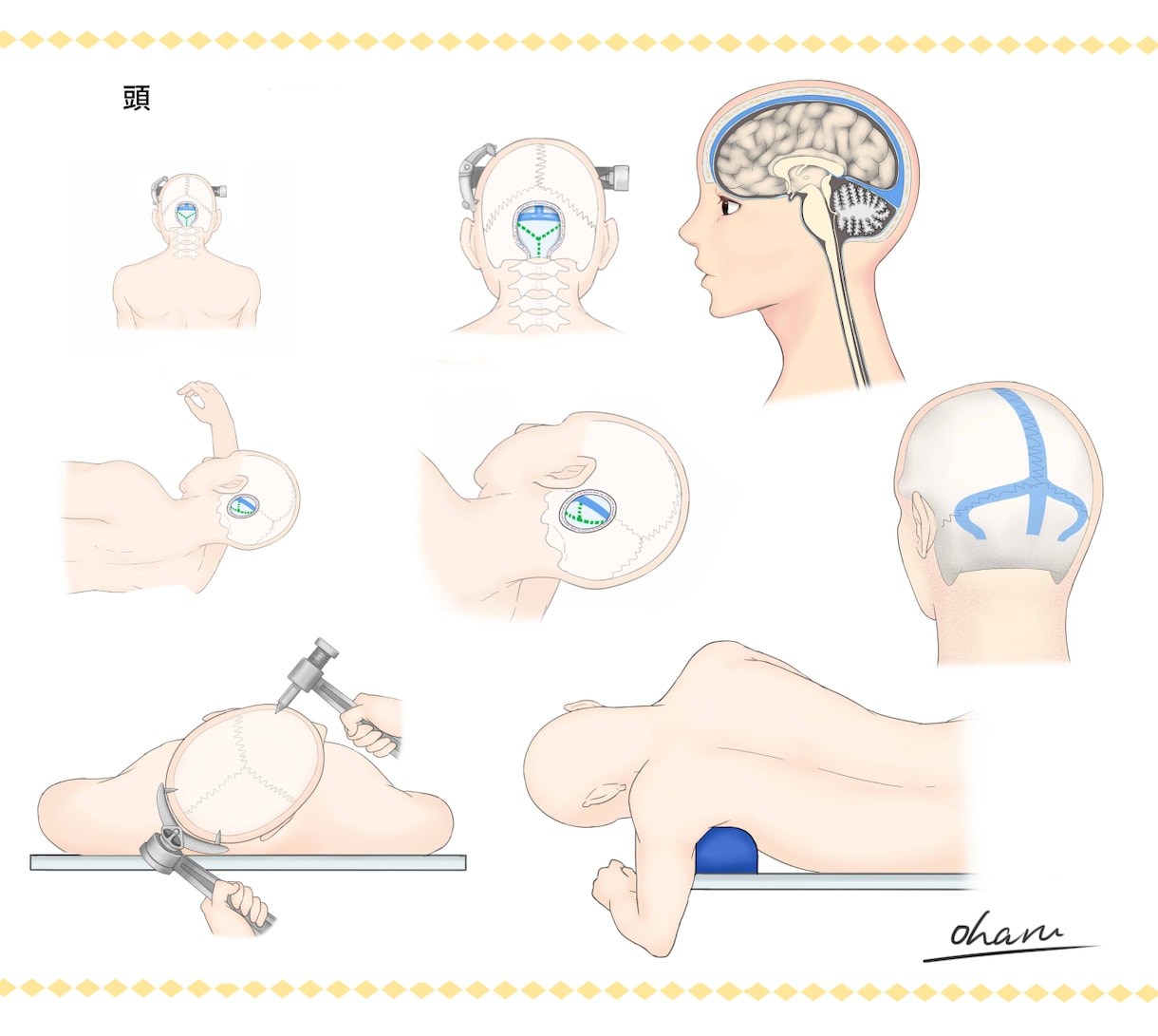 論文、書籍で使用するメディカルイラスト制作します 脳専門。2000枚以上制作しました。 イメージ2