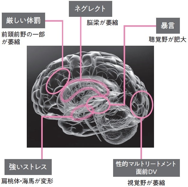 親といると辛い、経験者が毒親悩み聞きます 23年毒親の元で過ごした経験者が語る、毒親対処を伝授します。 イメージ6