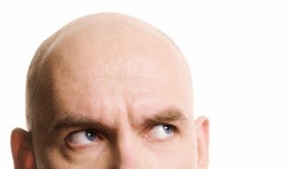 薄毛でお悩みの方。格安！私の成功法お教えします 若禿の私が実際に行い成功した、格安な方法お教えします！ イメージ1