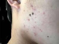 肌のお悩みの相談乗ります 肌荒れ、乾燥肌、毛穴がきになる方へ イメージ2