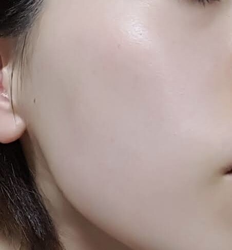 お肌スキンケアの方法教えます むきたての卵の様なお肌を目指しませんか イメージ1