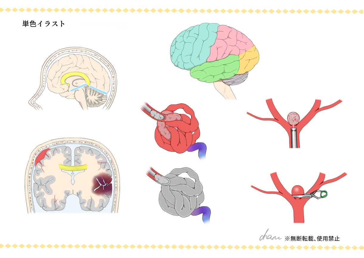 論文、書籍で使用するメディカルイラスト制作します 脳専門。2000枚以上制作しました。 イメージ3