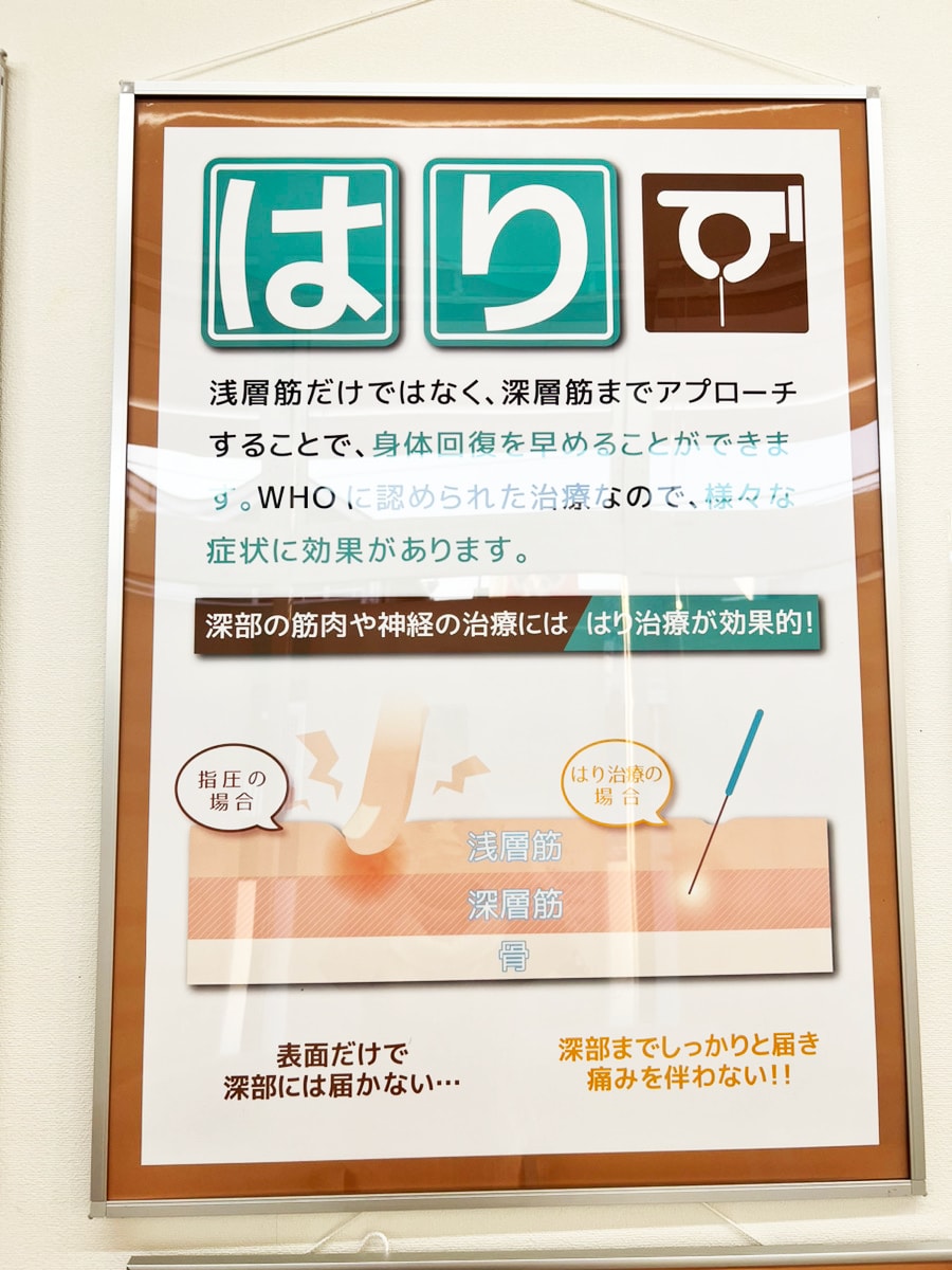 整骨院特化！ポスターデザイン、印刷までいたします 45店舗運営実績があるから反応率も分かる！確実なPOP制作 イメージ5