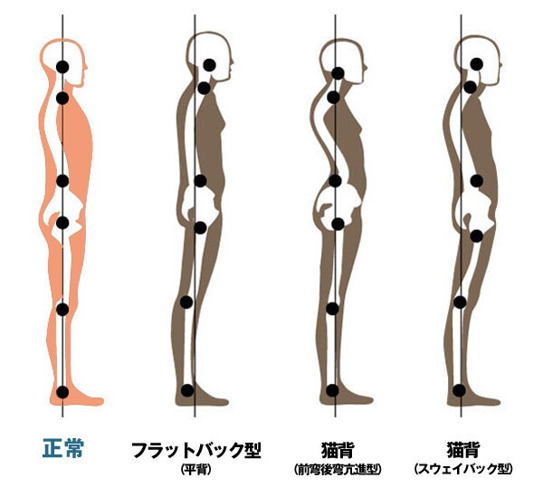 体の重心バランスのズレを鼻緒テーピング法ます バランス改善。後は仙腸関節テーピング イメージ1