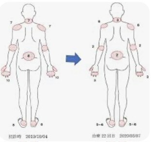線維筋痛症の方、会話で共感が出来ます 自分も線維筋痛症です！貴方の痛い、辛いのがわかります！ イメージ2