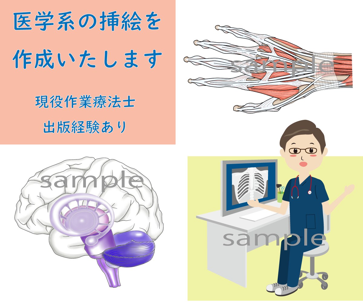 医療系の詳細な挿絵を作成します 著作権や個人情報保護法侵害の心配なし！研究論文や医学書に！ イメージ1