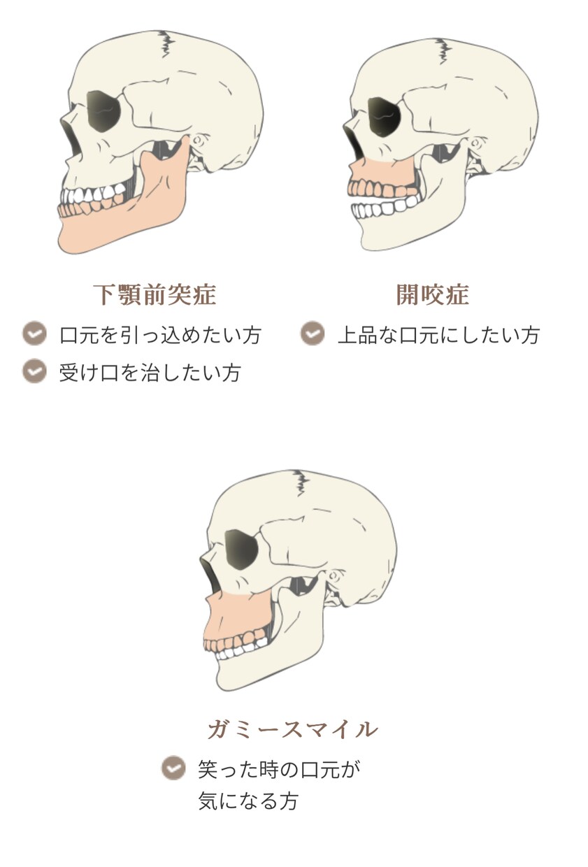 顔写真から必要な美容整形を診断・提案します 元大手美容外科カウンセラーが必要な手術やオペ内容を徹底解説！ イメージ6