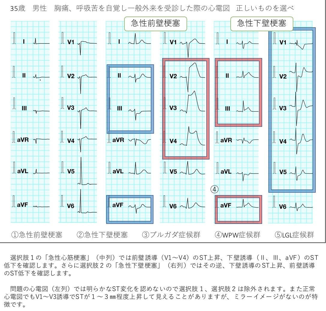 心電図検定対策講座　問題集をお渡します 心電図検定を受験予定の方必見！2-4級レベル解説付き50問！ イメージ3