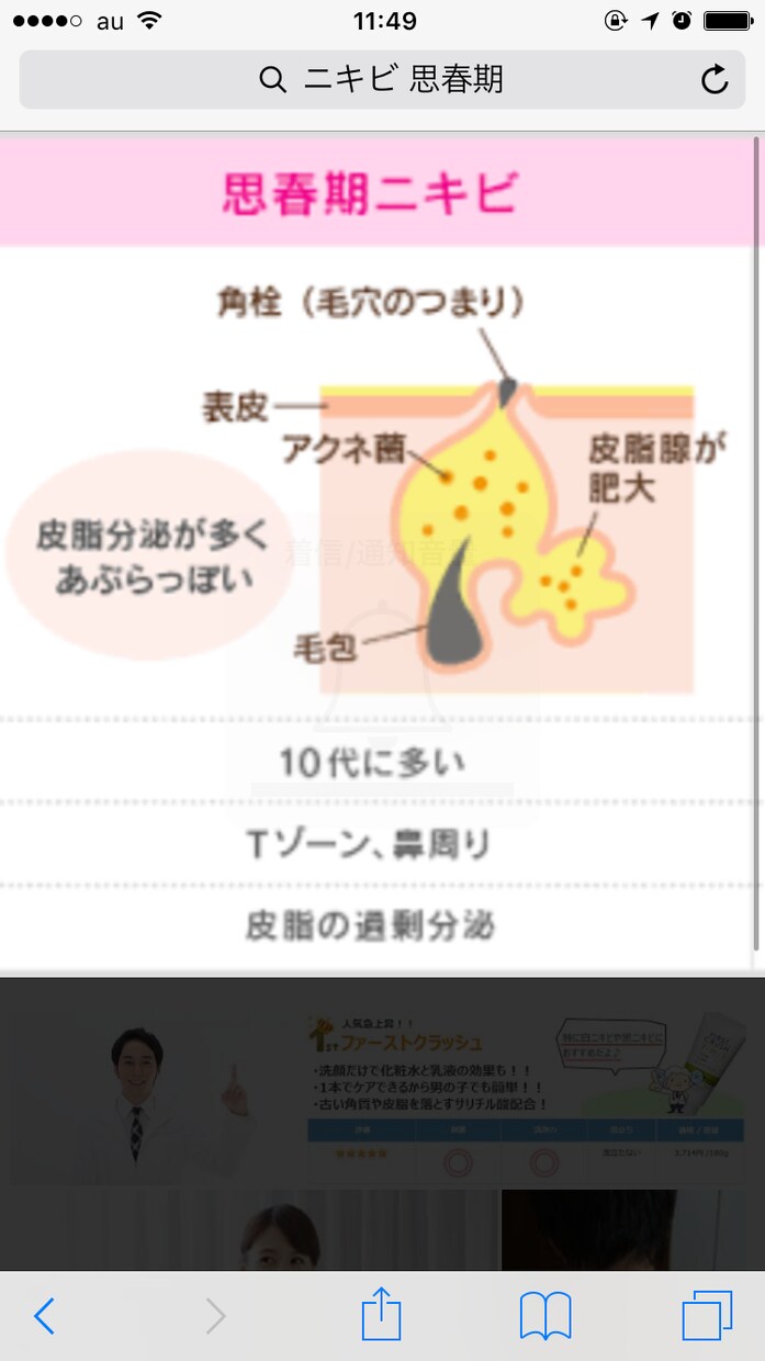 思春期ニキビの改善方法を提案します 中学生、高校生真っ赤な思春期ニキビにお困りの方 イメージ1