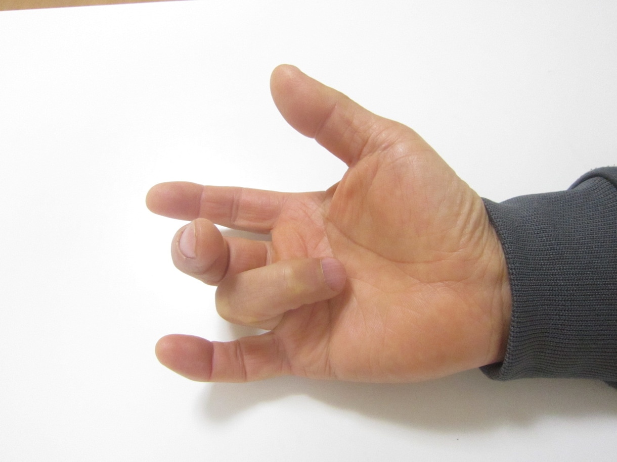 簡単な指体操だけで治る”ばね指”の治療法を教えます えッこんな簡単な指体操で！　即効性にきっと歓喜するでしょう。 イメージ1