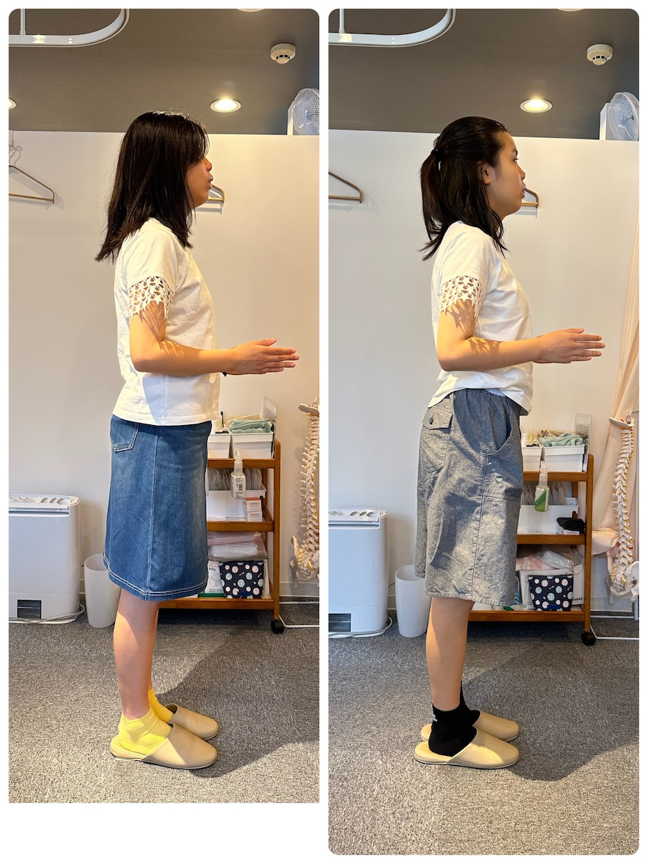肩こり腰痛姿勢分析＆セルフケアをアドバイスします 経験豊富な柔道整復師が猫背・巻き肩・反り腰など歪みをチェック イメージ3