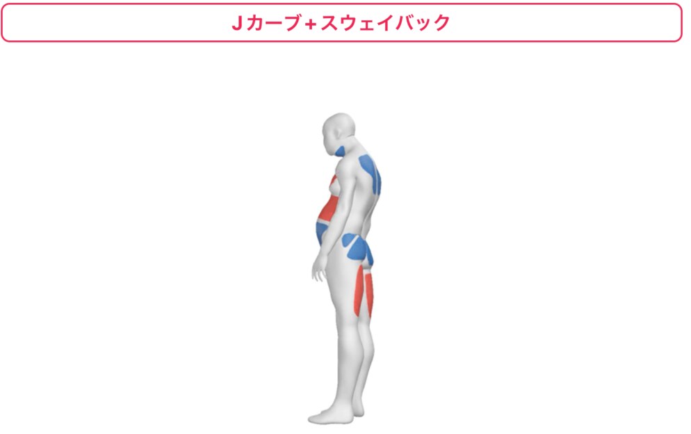 腰痛・肩こりの方の姿勢をAI分析、判定します 今の痛みの原因だけでなく、未来の姿勢まで可視化できる！ イメージ2