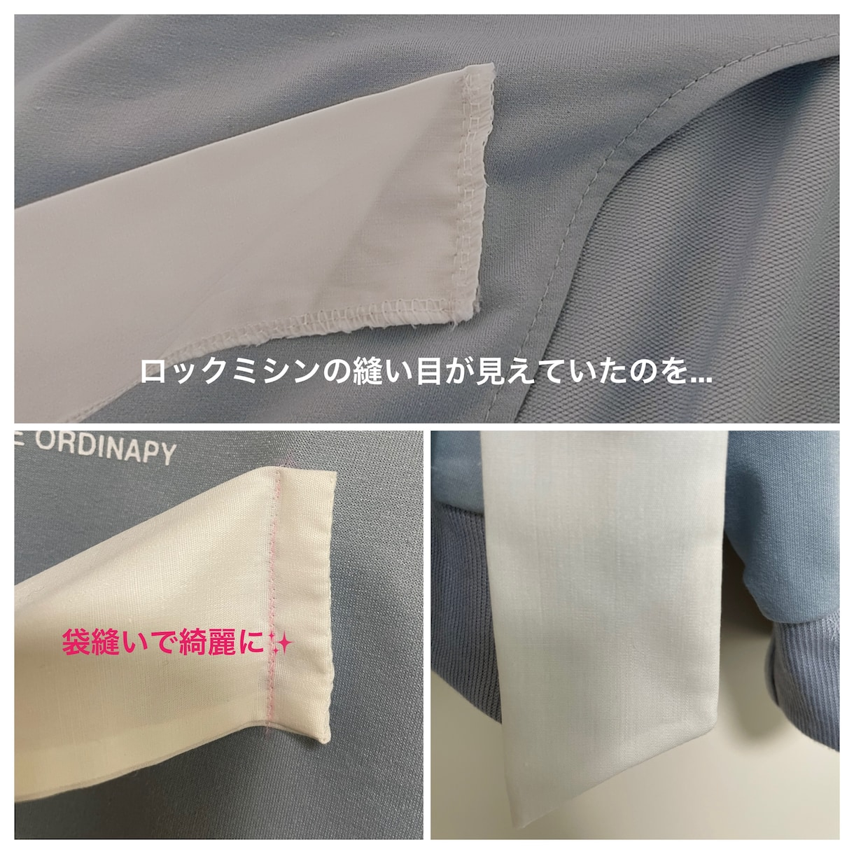 服の簡単なお直し・修繕します 専門店に出すまでもないプチ補修はここで！ イメージ2