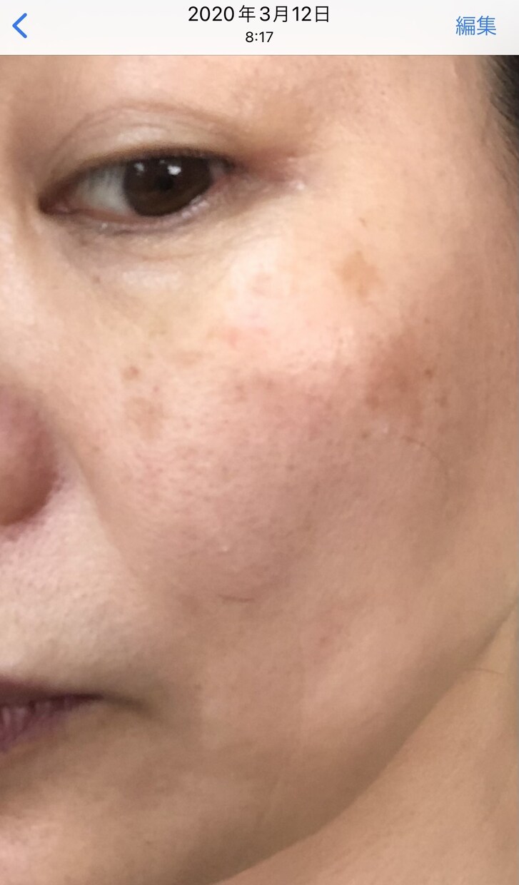 細胞を元気にするアドバイスをします 薄毛改善、アンチエイジング、健康寿命を延ばしたい方に。 イメージ2