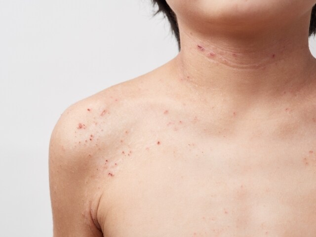 アレルギー克服体験からアトピーの治し方を提供します 薬を使わず、原因は何か。常識を疑い・食生活改善を提案します。 イメージ5