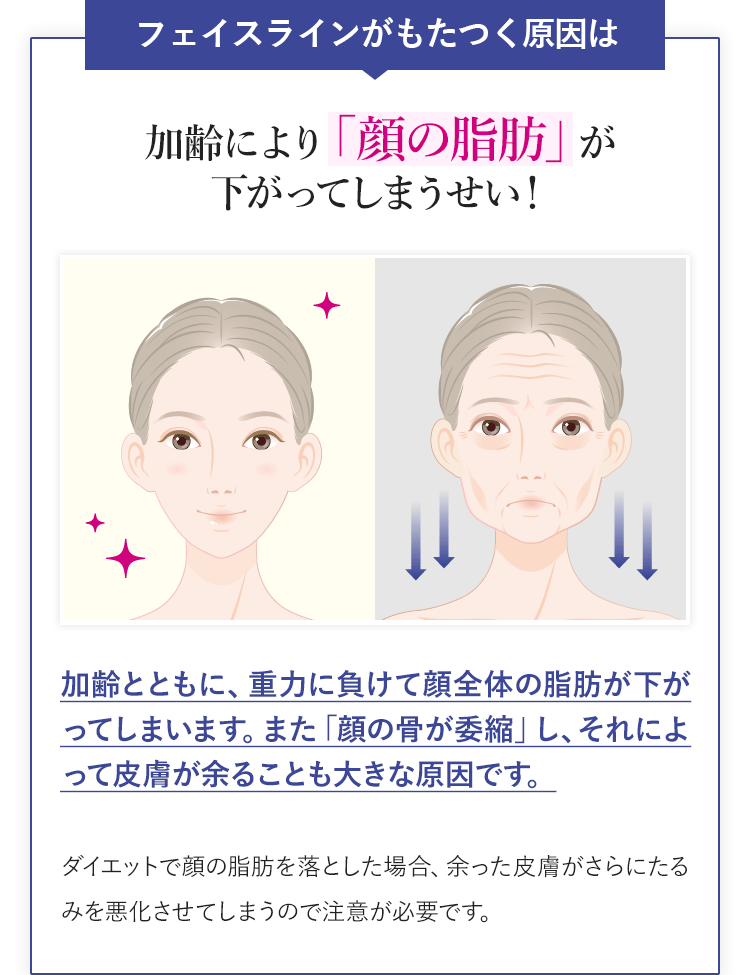 話題の「糸リフト」について当事者が相談に乗ります 「糸リフト」について知りたくありませんか？ イメージ2