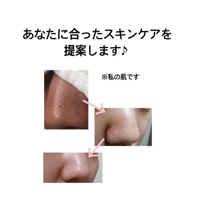 肌のお悩みに合わせたスキンケアを提案します あなたに合ったスキンケアを一緒に探しましょう◎ イメージ1
