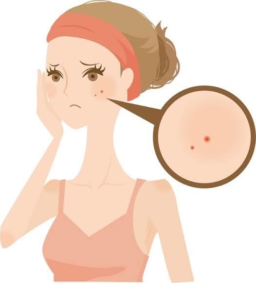 特にニキビお悩みの方向け。肌質改善を得意としてます 誰でも美しい肌を作ることができます。 イメージ1