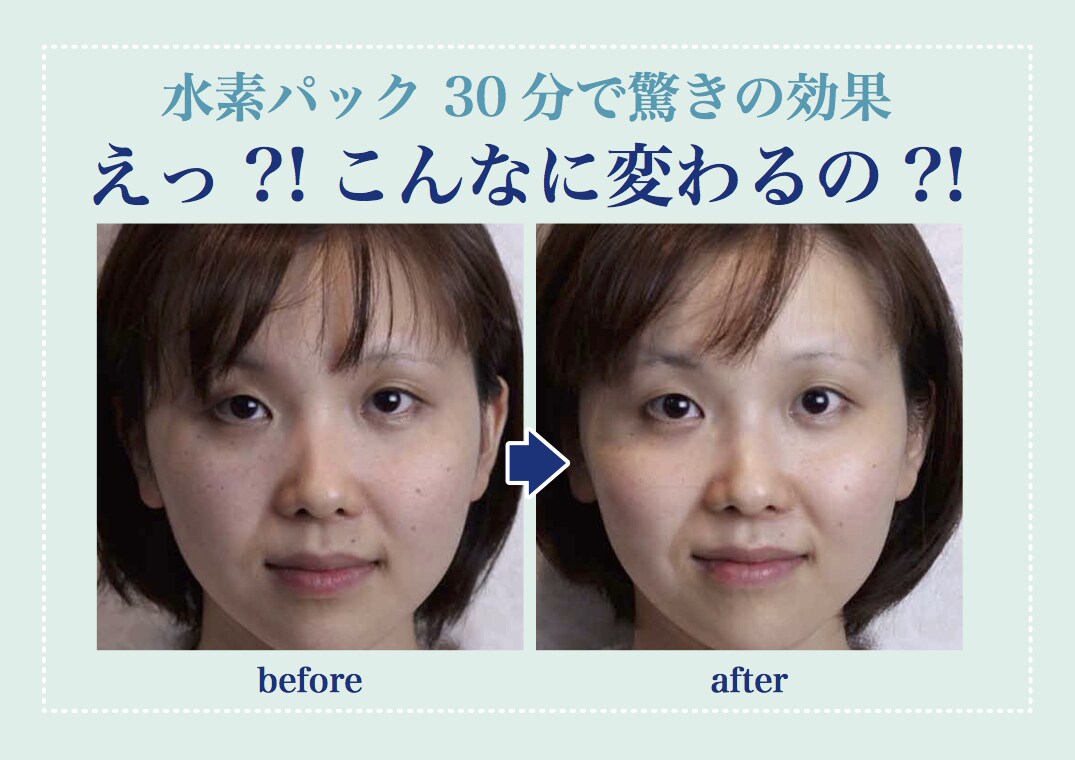 お肌のお悩みを解決します 30分後は5年前の生まれたての素肌に イメージ2