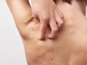 あなたのつらい強烈な肌トラブルを根本から改善します 全身に血液とリンパの流れを良くし強烈な肌トラブルを解消します イメージ1