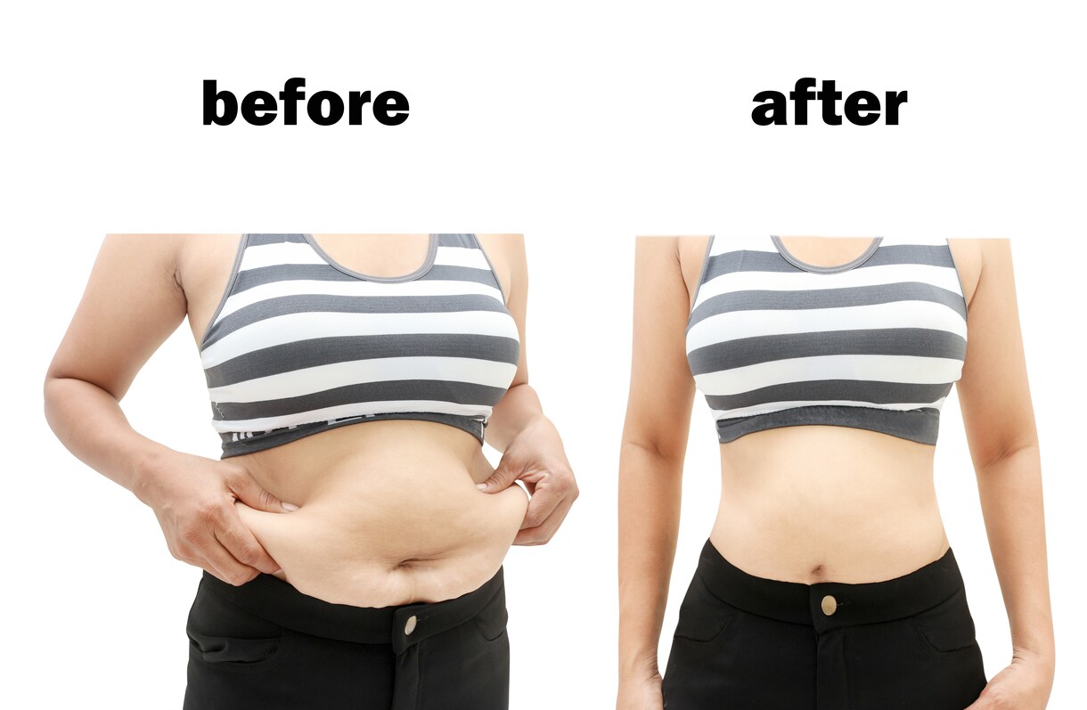 期間延長でダイエットを徹底サポートします さらにダイエットを継続したい方や体型を維持したい方へ イメージ1