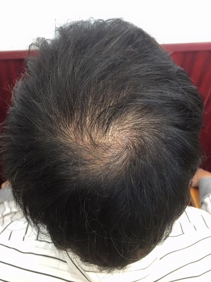 初回特価⭐︎育毛Only Oneアドバイスをします ＼先着30名様限定／自宅で育毛にコミット！最適なアドバイス イメージ4