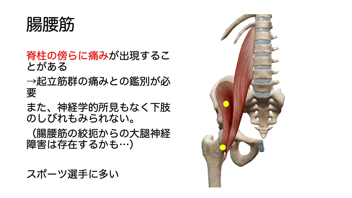 腰痛についてまとめたことをお伝えします 目の前の患者様や自分の腰痛はどういった腰痛か知っていますか？ イメージ5