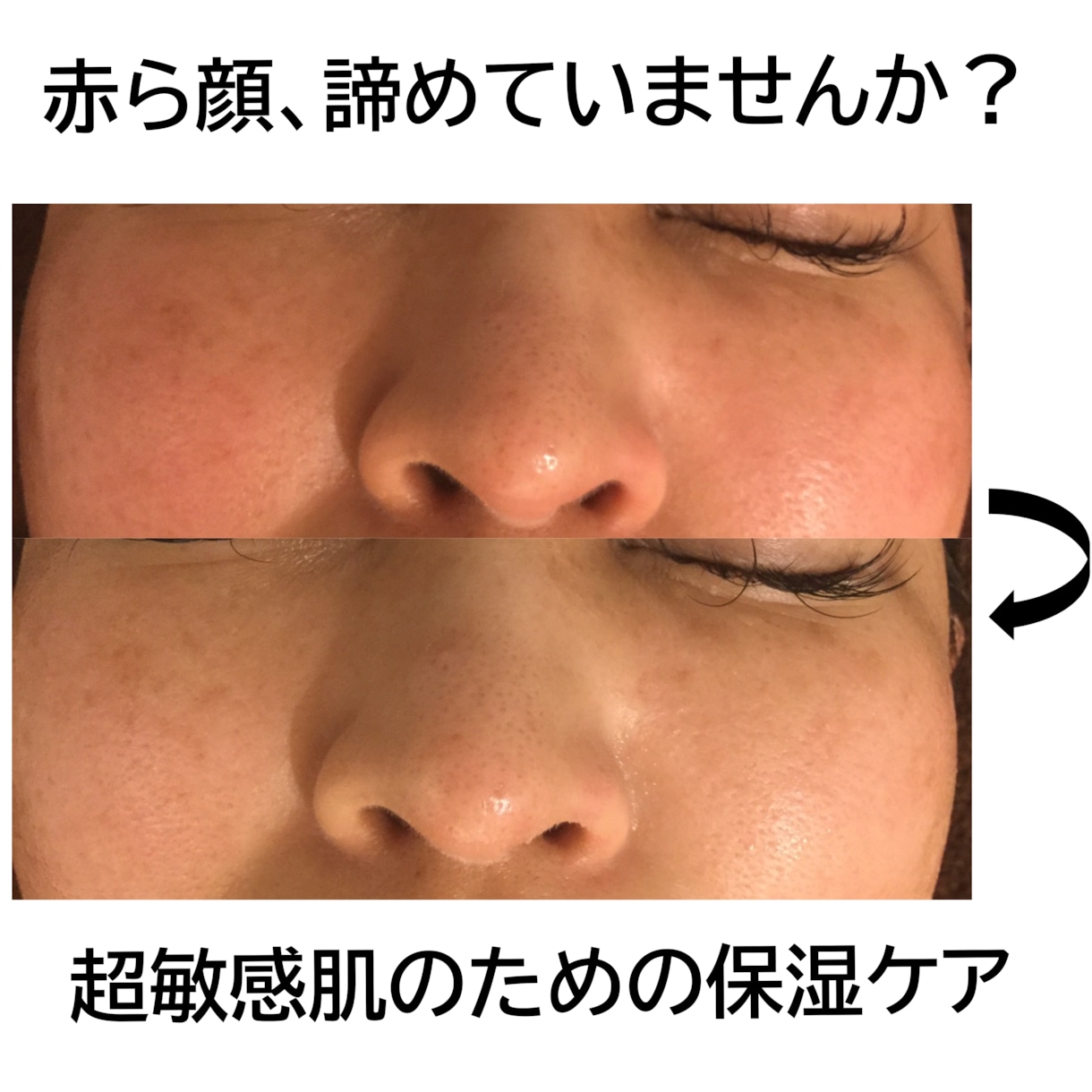 超敏感肌・アトピー肌のホームケをお教え致します ひとりひとりの生活に合わせたホームケアとスキンケアをご紹介 イメージ9