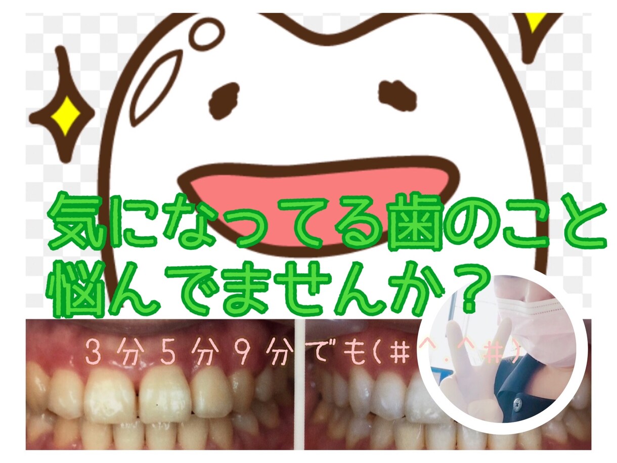 お口の気になること教えます 歯科衛生士があなたの気になってる症状、悩みなどお答えします イメージ1