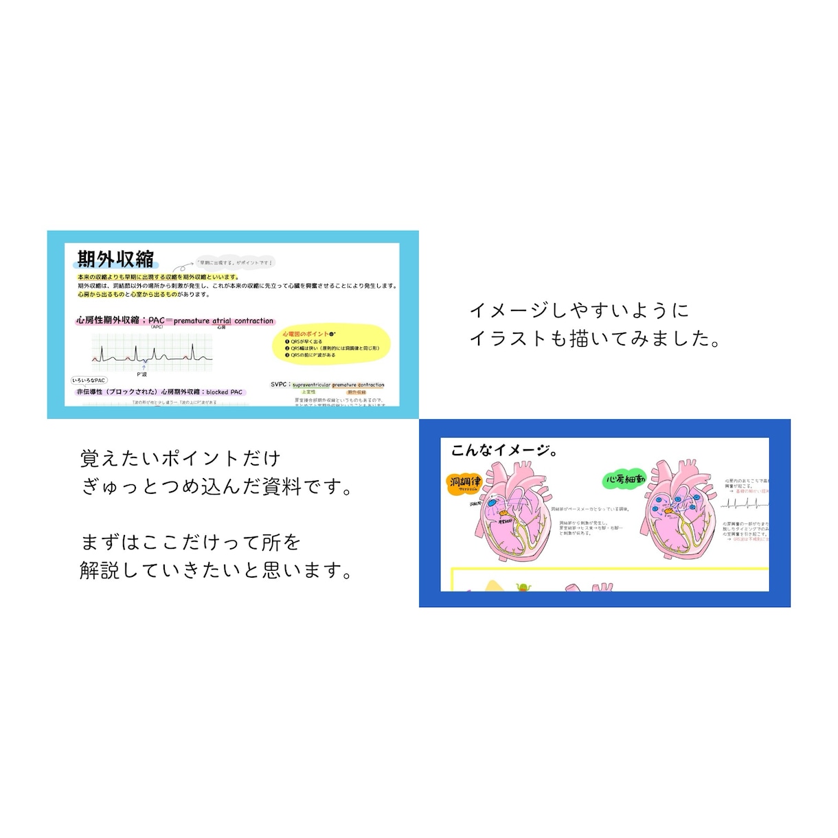 モニター心電図の読み方をお教えします サクッと心電図を読めるようになりたい方 イメージ4
