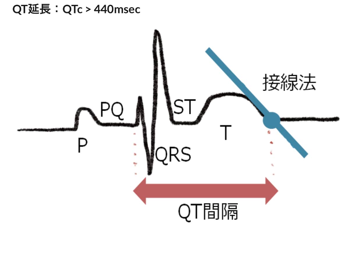 心電図検定1級が心電図検定試験に向け相談に応じます 臨床・試験対策・症例読影まで幅広く対応！ イメージ2