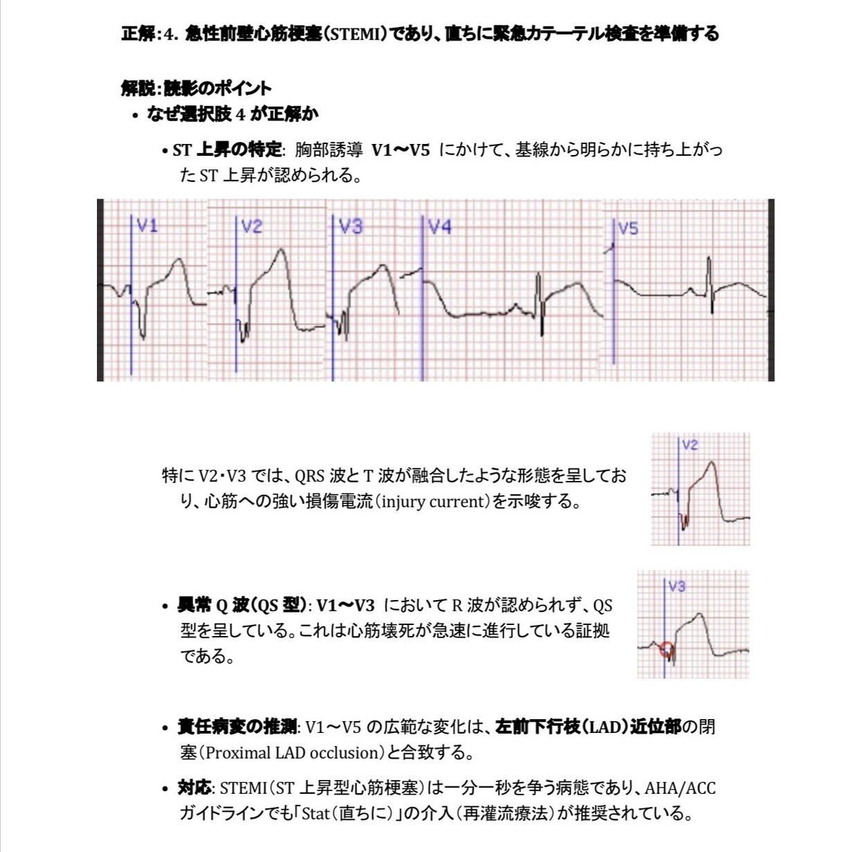 心電図検定1級が心電図検定試験に向け相談に応じます 臨床・試験対策・症例読影まで幅広く対応！ イメージ5