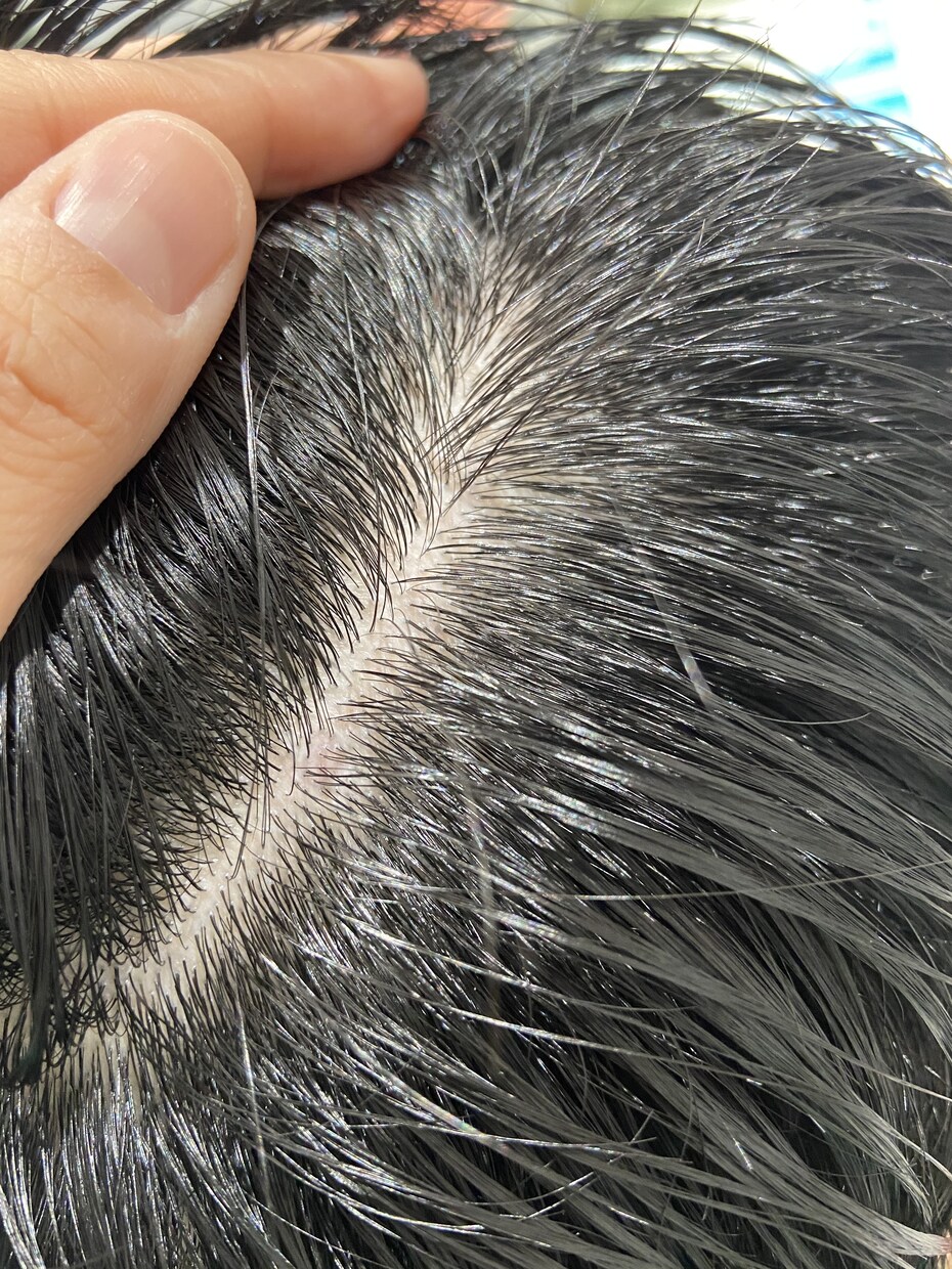 お金と時間をかけず白髪を無くす方法お伝えします 【37歳白髪なし】スパニストが実際にやってる頭皮マッサージ！ イメージ1