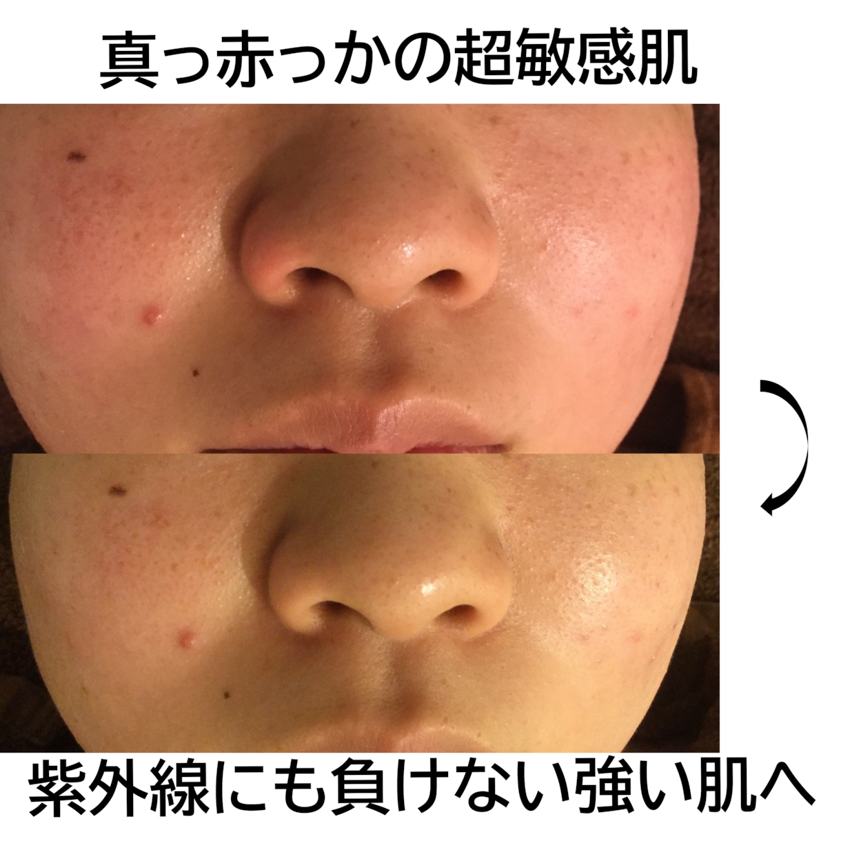 超敏感肌・アトピー肌のホームケをお教え致します ひとりひとりの生活に合わせたホームケアとスキンケアをご紹介 イメージ2