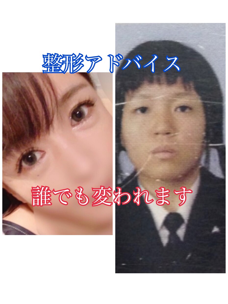 整形で人生180度変わった私がアドバイスします 女は結局外見でした。生まれ変わって人生変えましょう。 イメージ1