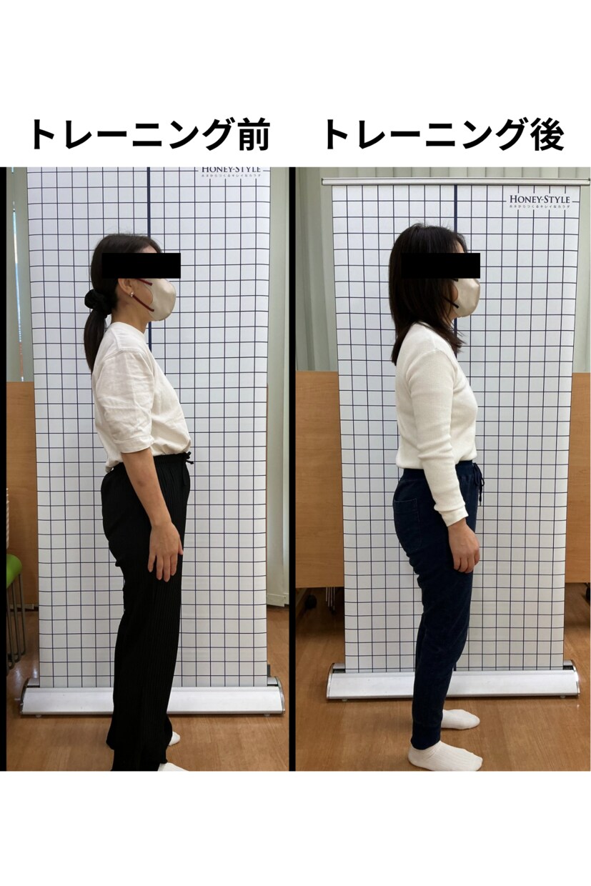 あなたの姿勢写真から姿勢改善トレーニングを教えます 必要なトレーニングだけではなく、睡眠、栄養アドバイスも！ イメージ1