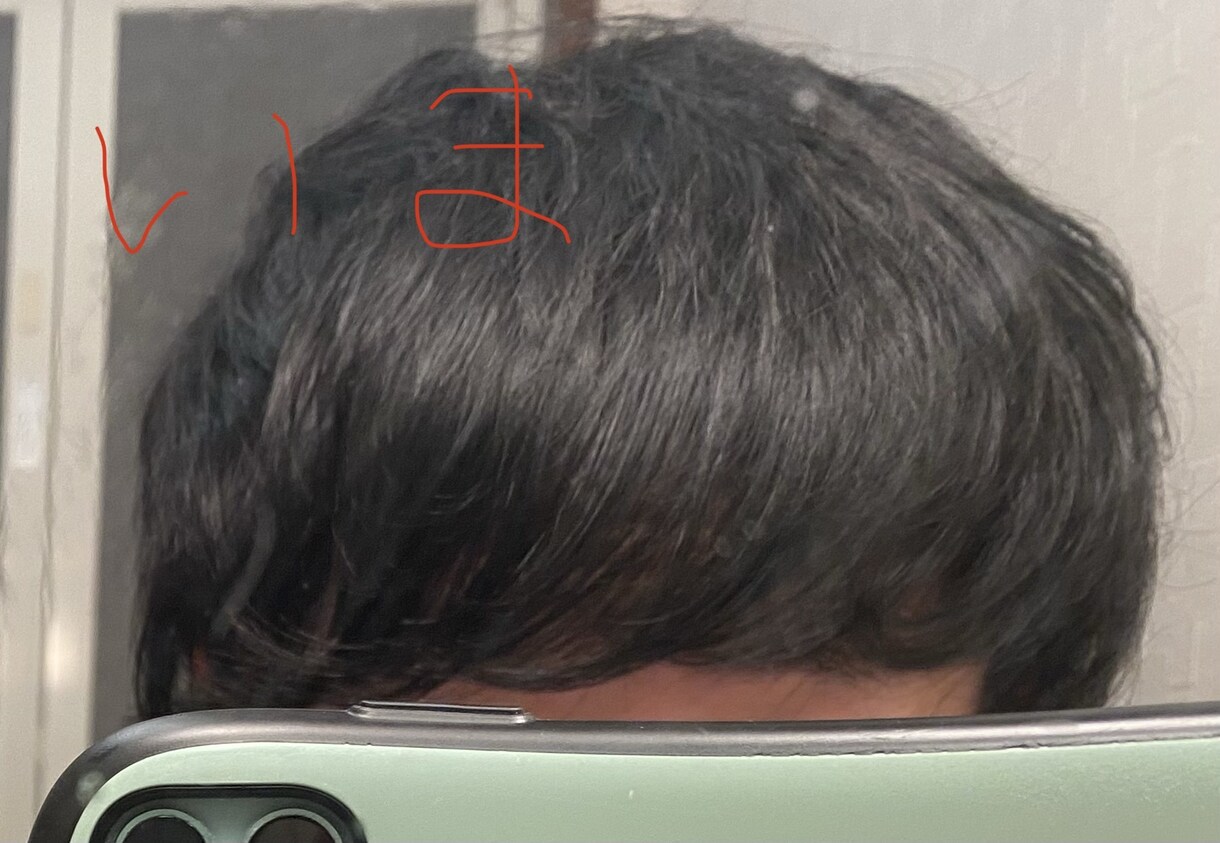 現役薬剤師がAGA・薄毛の相談に乗ります 本業は医薬品の相談窓口担当です。 イメージ2
