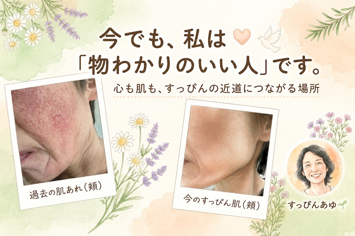くり返す肌荒れ経験者がその苦しさ受けとめます ずっとくり返す、なんで私だけ？　もうイヤ！！ イメージ1