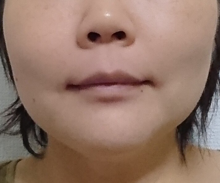 美肌の秘訣とお肌のお悩みにお答えします 何をやっても肌トラブルが消えない貴女へ。 イメージ1