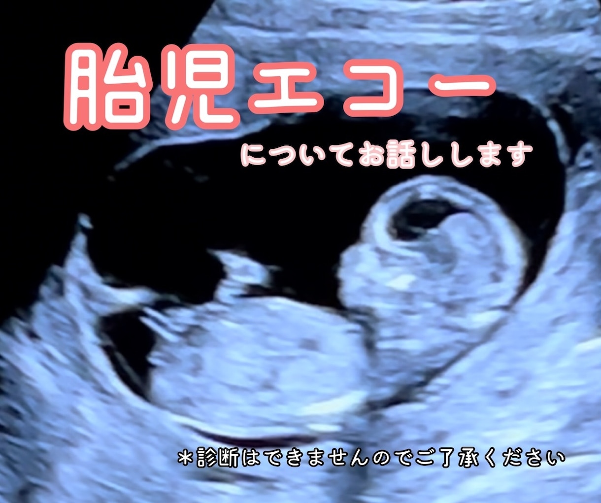 現役助産師が胎児エコーの疑問にお答えします 妊婦健診では聞きにくいこと、何でもお聞きくださいね イメージ1