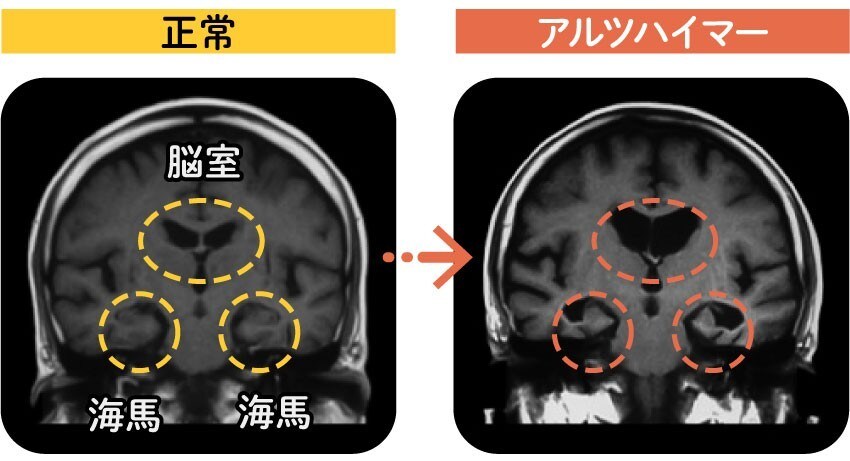 健康・認知症予防運動,プランを提供します 人生100年時代を健康に生きるために。 イメージ2
